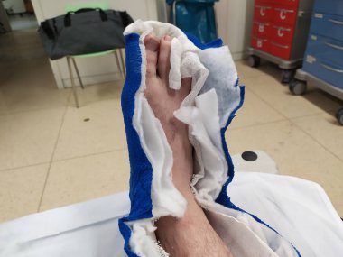 Hastanenin yaralı bacağı