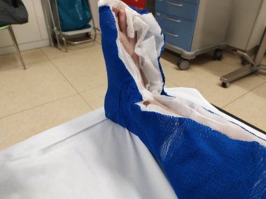 Hastanenin yaralı bacağı