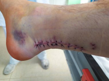 Hastanede yaralı bir adam var.