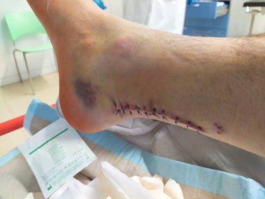 Hastanede yaralı bir adam var.