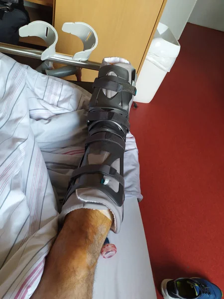 Пошкоджена Нога Пацієнта Лікарні — стокове фото