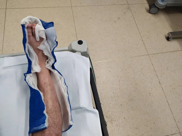 Τραυματισμένο Πόδι Ασθενούς Στο Νοσοκομείο — Φωτογραφία Αρχείου