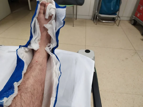 Verletztes Bein Des Patienten Krankenhaus — Stockfoto