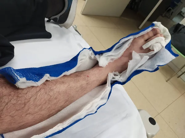 Injured Leg Patient Hospital — Stock Photo, Image