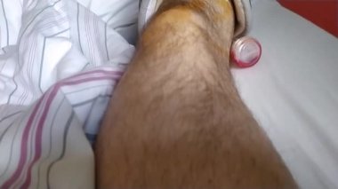 Aşil tendonu olan Avrupalı bir adam hastane yatağında özel ayakkabı ve koltuk değnekleri ile yatıyor.