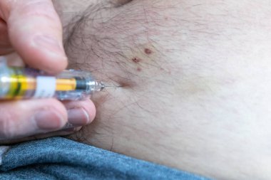 Aşil tendonu olan Avrupalı bir adam, tromboz miyokardiyal enfarktüsü önlemek için karnına enoksiaparin ya da dalteparin enjekte ettikten sonra deri altında prefabrik şırınga ile yırtılır.