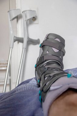 Achilles tendon yırtılması ameliyatından sonra Avrupalı bir adam özel fizyoterapi ayakkabısı ve iyileşmek için koltuk değnekleriyle eve döndü.