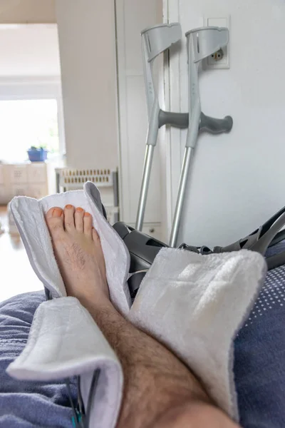 Homem Europeu Após Operação Ruptura Tendão Aquiles Está Volta Para — Fotografia de Stock
