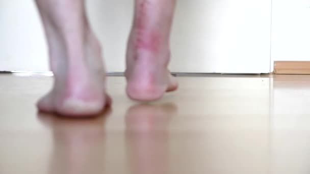 European Man First Steps Achilles Tendon Rupture Operation Shows Wound — Αρχείο Βίντεο