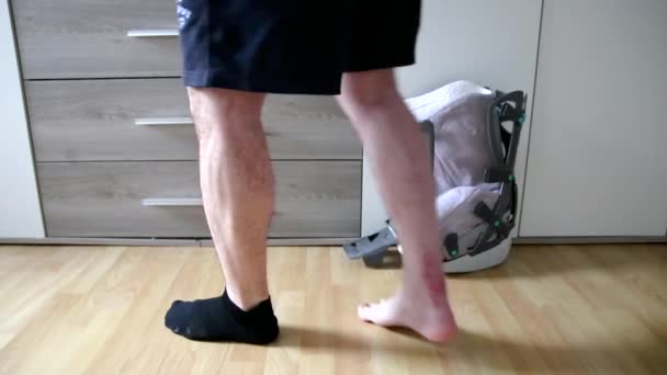 European Man First Steps Achilles Tendon Rupture Operation Shows Wound — Wideo stockowe