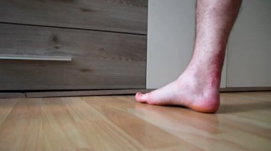 Aşil tendon yırtılması ameliyatından sonra Avrupalı bir adam iyileşme aşil tendonu eğitimini acı verici bir egzersizle topuk ve ayak bileklerindeki güç ve hareketliliği rehabilitasyon fizyoterapisti tarafından yeniden kazanmak için verir.