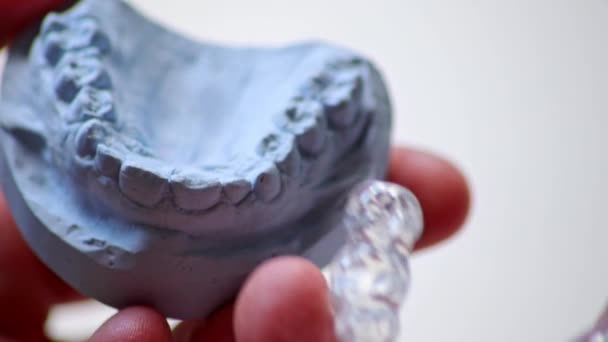 歯の整形と歯の分割を手で保持している歯の保護のための歯科保護のための歯科手術として歯の保護のための歯垢による過小またはクロスバイトに対するブレース — ストック動画