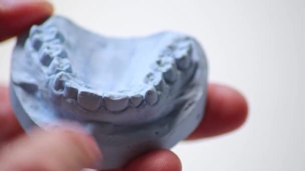 Ортодонт Тримає Зубний Відбиток Розщеплюється Руками Захисту Зубів Від Синдрому — стокове відео