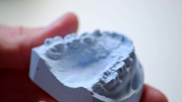 Ortodonta Trzymający Odcisk Zęba Szynę Dentystyczną Dłońmi Celu Ochrony Zębów — Wideo stockowe