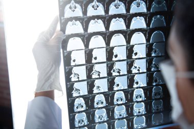 Kadın doktor bilgisayar tomografisine bakıyor. 