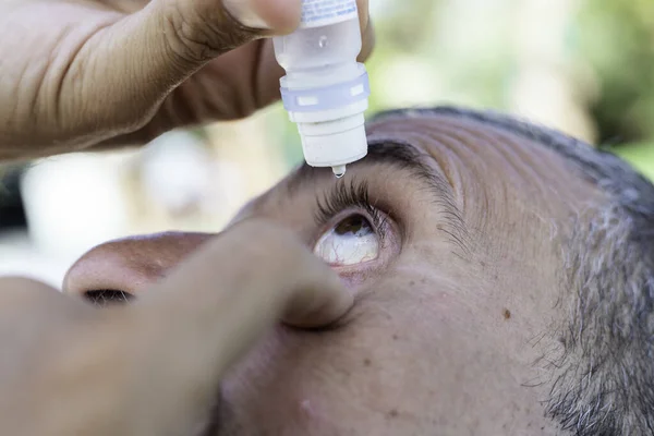 Man Putting Eye Drops Irritated Eye Vision Irritated Eye Blood Imagen De Stock