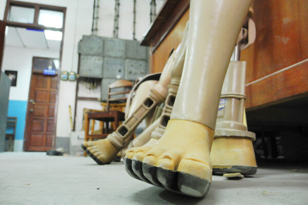 Мастерская протезов ног, искусственные конечности
