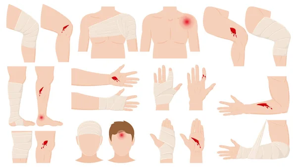 Tecknad fysisk skada, sår bandage applicering koncept. Öppna och bandagerade mänskliga kroppsdelar, behandlade sår, frakturer vektor illustration. Behandling av kroppsskador hos människa — Stock vektor