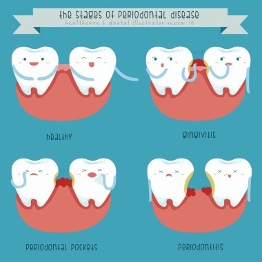The stages of periodontal disease clipart