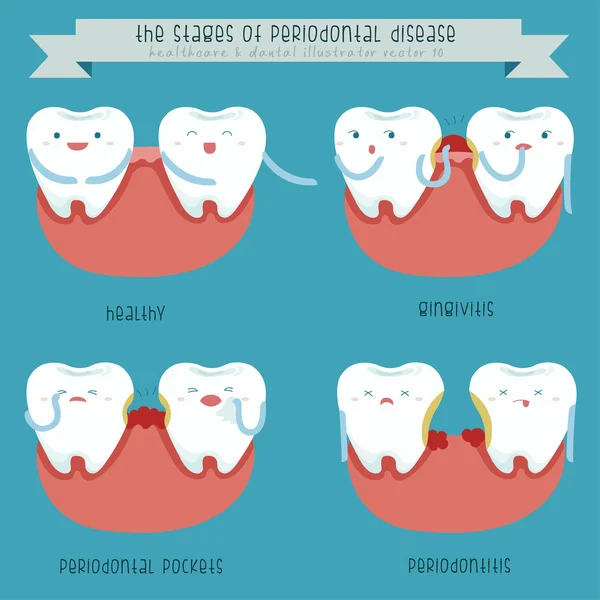 periodontal hastalık aşamalarında
