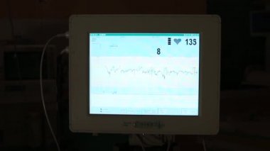Bilgisayar monitörü hastaların sağlık durumlarını inceler. Kalp atışı taraması