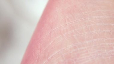 Kuru cilt çocukları bacağı. Yeni doğmuş bir bebeğin epitelyumunun üst katmanını değiştir.