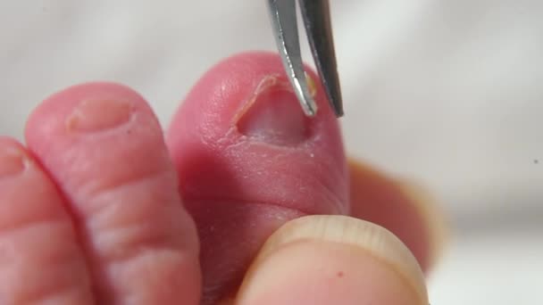 Makro záběr na dětský nehet stříhaný nůžkami. — Stock video