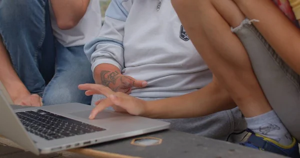 Utilizzando una tastiera del computer portatile. La mano adolescente, persona con disabilità fisiche — Foto Stock