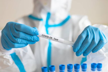 Laboratuvar laboratuarında hemşire doktor tarafından yapılan koronavirüs PCR antijen testi süreci, COVID-19 örnek toplama kiti, OP NP hasta numunesi almak için test tüpü, bir test örneği almak için hasta