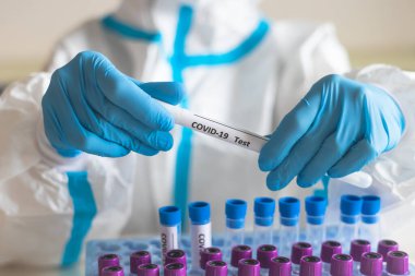 Laboratuvar laboratuarında hemşire doktor tarafından yapılan koronavirüs PCR antijen testi süreci, COVID-19 örnek toplama kiti, OP NP hasta numunesi almak için test tüpü, bir test örneği almak için hasta