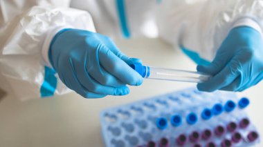 Laboratuvar laboratuarında hemşire doktor tarafından yapılan koronavirüs PCR antijen testi süreci, COVID-19 örnek toplama kiti, OP NP hasta numunesi almak için test tüpü, bir test örneği almak için hasta