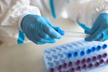 Laboratuvar laboratuarında hemşire doktor tarafından yapılan koronavirüs PCR antijen testi süreci, COVID-19 örnek toplama kiti, OP NP hasta numunesi almak için test tüpü, bir test örneği almak için hasta
