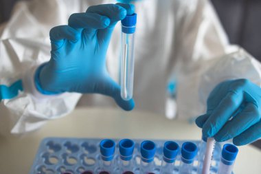 Laboratuvar laboratuarında hemşire doktor tarafından yapılan koronavirüs PCR antijen testi süreci, COVID-19 örnek toplama kiti, OP NP hasta numunesi almak için test tüpü, bir test örneği almak için hasta