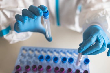 Laboratuvar laboratuarında hemşire doktor tarafından yapılan koronavirüs PCR antijen testi süreci, COVID-19 örnek toplama kiti, OP NP hasta numunesi almak için test tüpü, bir test örneği almak için hasta