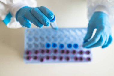 Laboratuvar laboratuarında hemşire doktor tarafından yapılan koronavirüs PCR antijen testi süreci, COVID-19 örnek toplama kiti, OP NP hasta numunesi almak için test tüpü, bir test örneği almak için hasta