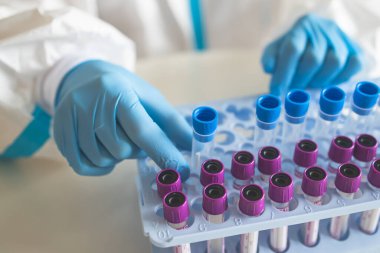 Laboratuvar laboratuarında hemşire doktor tarafından yapılan koronavirüs PCR antijen testi süreci, COVID-19 örnek toplama kiti, OP NP hasta numunesi almak için test tüpü, bir test örneği almak için hasta