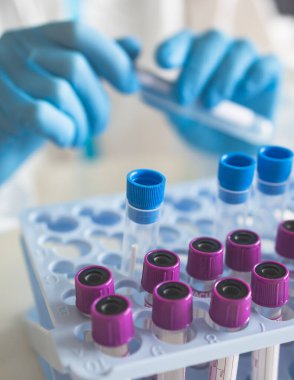 Laboratuvar laboratuarında hemşire doktor tarafından yapılan koronavirüs PCR antijen testi süreci, COVID-19 örnek toplama kiti, OP NP hasta numunesi almak için test tüpü, bir test örneği almak için hasta
