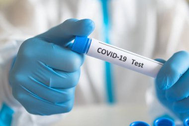Laboratuvar laboratuarında hemşire doktor tarafından yapılan koronavirüs PCR antijen testi süreci, COVID-19 örnek toplama kiti, OP NP hasta numunesi almak için test tüpü, bir test örneği almak için hasta