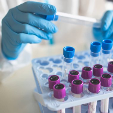 Laboratuvar laboratuarında hemşire doktor tarafından yapılan koronavirüs PCR antijen testi süreci, COVID-19 örnek toplama kiti, OP NP hasta numunesi almak için test tüpü, bir test örneği almak için hasta