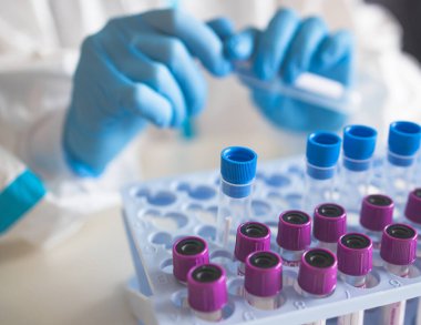 Laboratuvar laboratuarında hemşire doktor tarafından yapılan koronavirüs PCR antijen testi süreci, COVID-19 örnek toplama kiti, OP NP hasta numunesi almak için test tüpü, bir test örneği almak için hasta