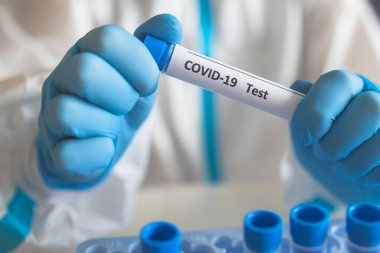 Laboratuvar laboratuarında hemşire doktor tarafından yapılan koronavirüs PCR antijen testi süreci, COVID-19 örnek toplama kiti, OP NP hasta numunesi almak için test tüpü, bir test örneği almak için hasta