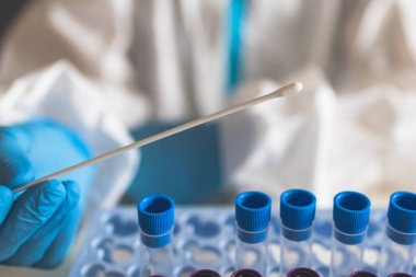 Laboratuvar laboratuarında hemşire doktor tarafından yapılan koronavirüs PCR antijen testi süreci, COVID-19 örnek toplama kiti, OP NP hasta numunesi almak için test tüpü, bir test örneği almak için hasta