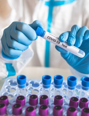 Laboratuvar laboratuarında hemşire doktor tarafından yapılan koronavirüs PCR antijen testi süreci, COVID-19 örnek toplama kiti, OP NP hasta numunesi almak için test tüpü, bir test örneği almak için hasta