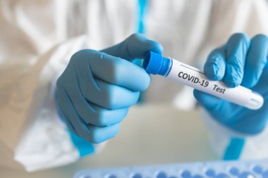 Laboratuvar laboratuarında hemşire doktor tarafından yapılan koronavirüs PCR antijen testi süreci, COVID-19 örnek toplama kiti, OP NP hasta numunesi almak için test tüpü, bir test örneği almak için hasta