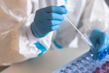 Laboratuvar laboratuarında hemşire doktor tarafından yapılan koronavirüs PCR antijen testi süreci, COVID-19 örnek toplama kiti, OP NP hasta numunesi almak için test tüpü, bir test örneği almak için hasta