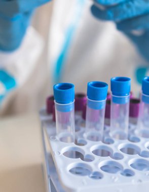 Laboratuvar laboratuarında hemşire doktor tarafından yapılan koronavirüs PCR antijen testi süreci, COVID-19 örnek toplama kiti, OP NP hasta numunesi almak için test tüpü, bir test örneği almak için hasta