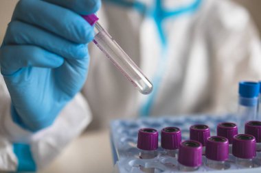 Laboratuvar laboratuarında hemşire doktor tarafından yapılan koronavirüs PCR antijen testi süreci, COVID-19 örnek toplama kiti, OP NP hasta numunesi almak için test tüpü, bir test örneği almak için hasta