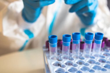 Laboratuvar laboratuarında hemşire doktor tarafından yapılan koronavirüs PCR antijen testi süreci, COVID-19 örnek toplama kiti, OP NP hasta numunesi almak için test tüpü, bir test örneği almak için hasta