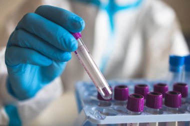 Laboratuvar laboratuarında hemşire doktor tarafından yapılan koronavirüs PCR antijen testi süreci, COVID-19 örnek toplama kiti, OP NP hasta numunesi almak için test tüpü, bir test örneği almak için hasta