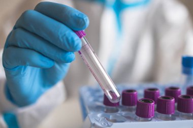 Laboratuvar laboratuarında hemşire doktor tarafından yapılan koronavirüs PCR antijen testi süreci, COVID-19 örnek toplama kiti, OP NP hasta numunesi almak için test tüpü, bir test örneği almak için hasta